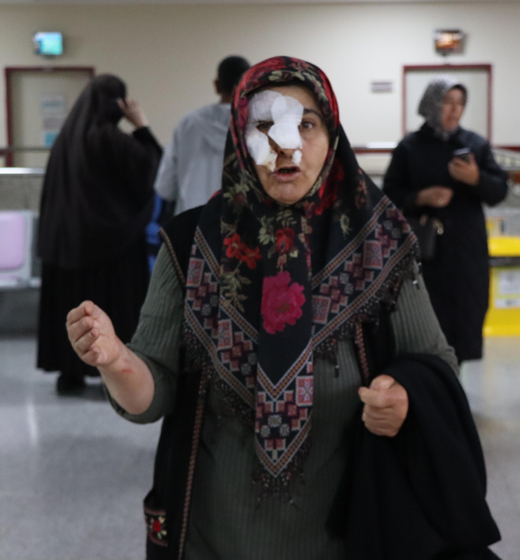 Başıboş köpeklerin saldırdığı kadın merdivenlerden düştü