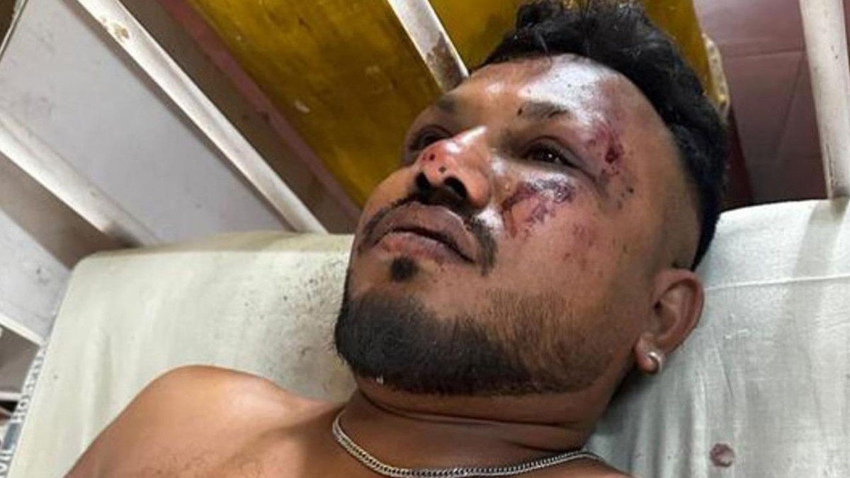 Uçak kazasından mucizevi bir şekilde sağ kurtulan adam hangi koltukta oturuyordu?