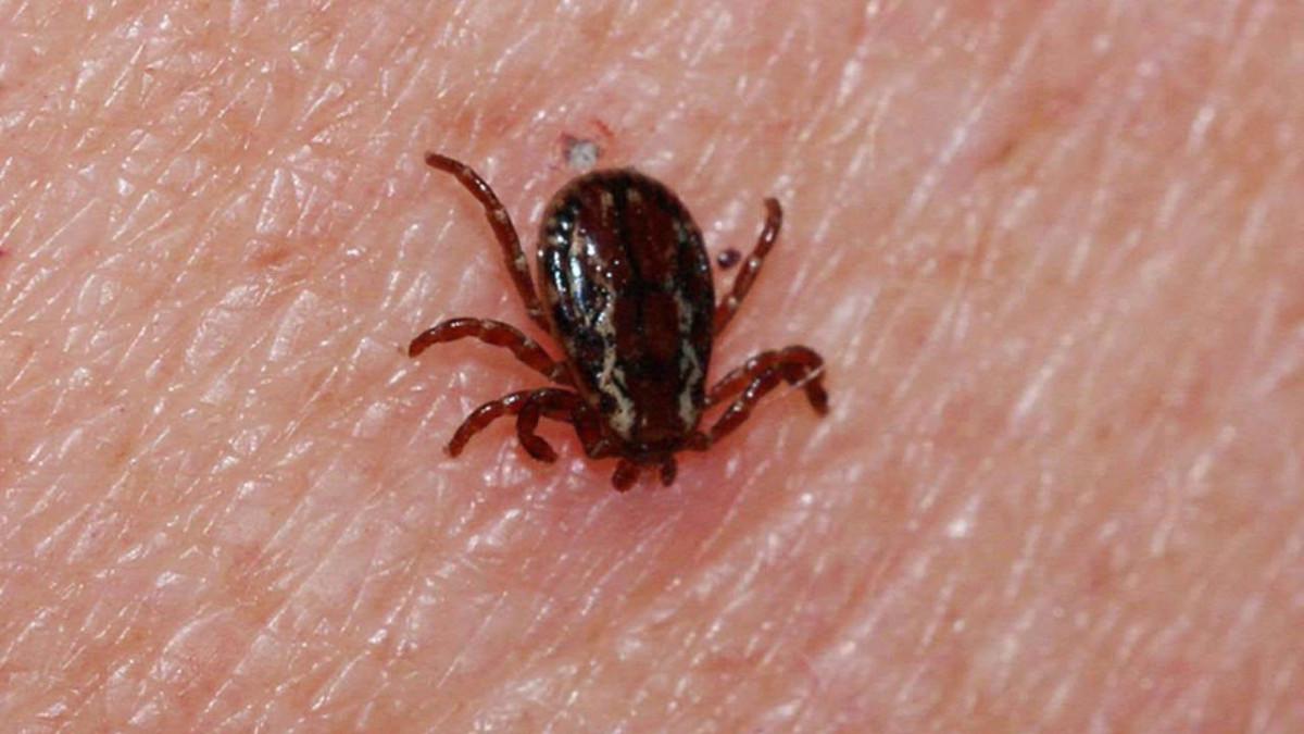 Bolu'da KKKA hastalığı tedavisi gören kişi hayatını kaybetti